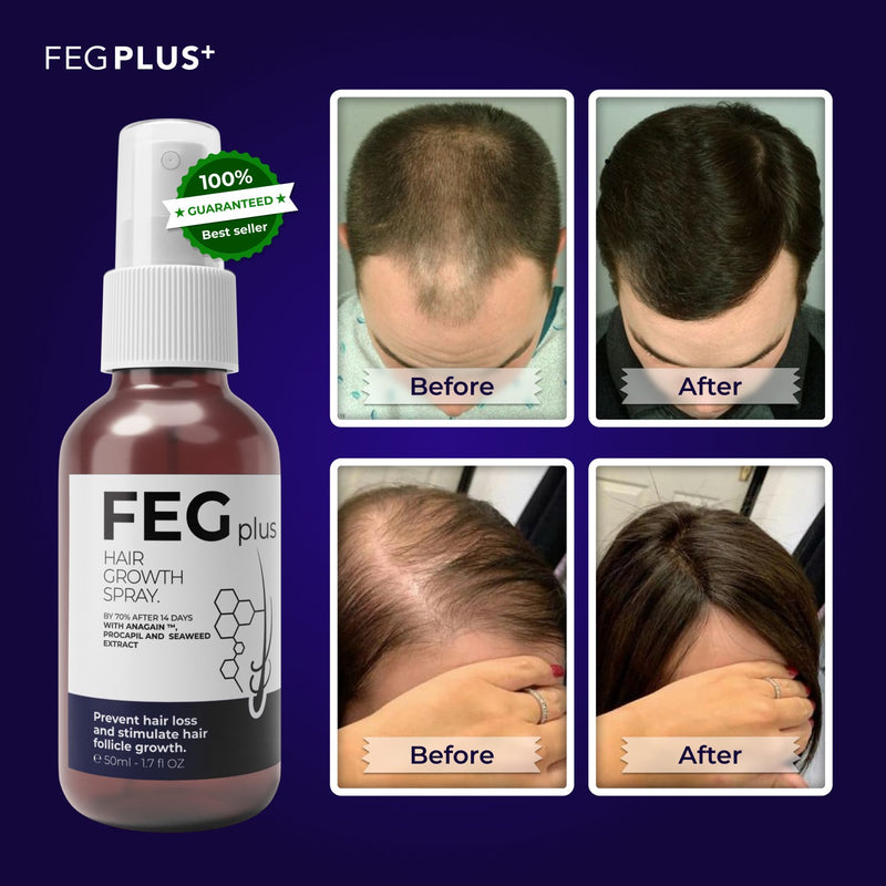 FEG hair growth spray